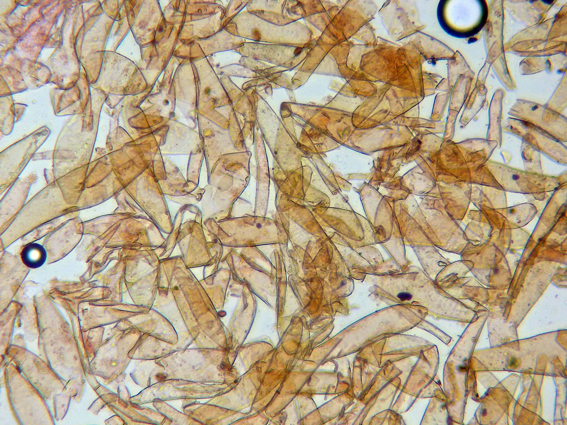 Microscopía de Psathyrella pennata - 10 - Hifas pilosidad sombrero x 400-003